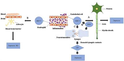 Matrix Metalloproteinase-9 as an Important Contributor to the Pathophysiology of Depression